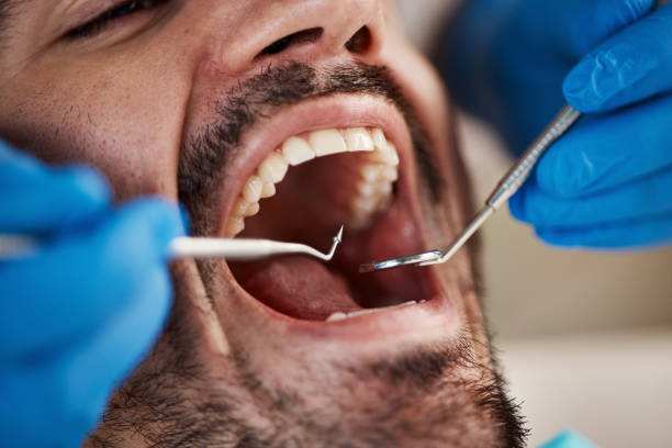 Oral Surgery in Citrus Heights, CA
